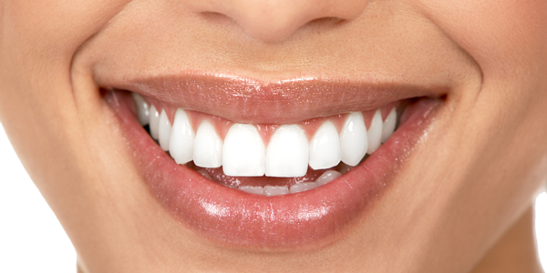 The cost of small comforts in an organisation